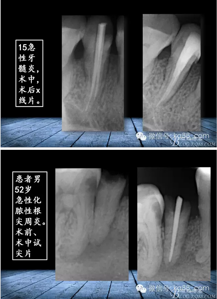 QQ圖片20150817141308.png