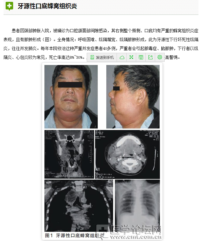 口腔疾病與全身系統(tǒng)性疾病的關系