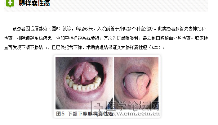 口腔疾病與全身系統(tǒng)性疾病的關系