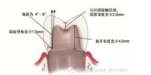 時常搞不清楚怎么備牙嗎？義獲嘉教您如何完美備牙