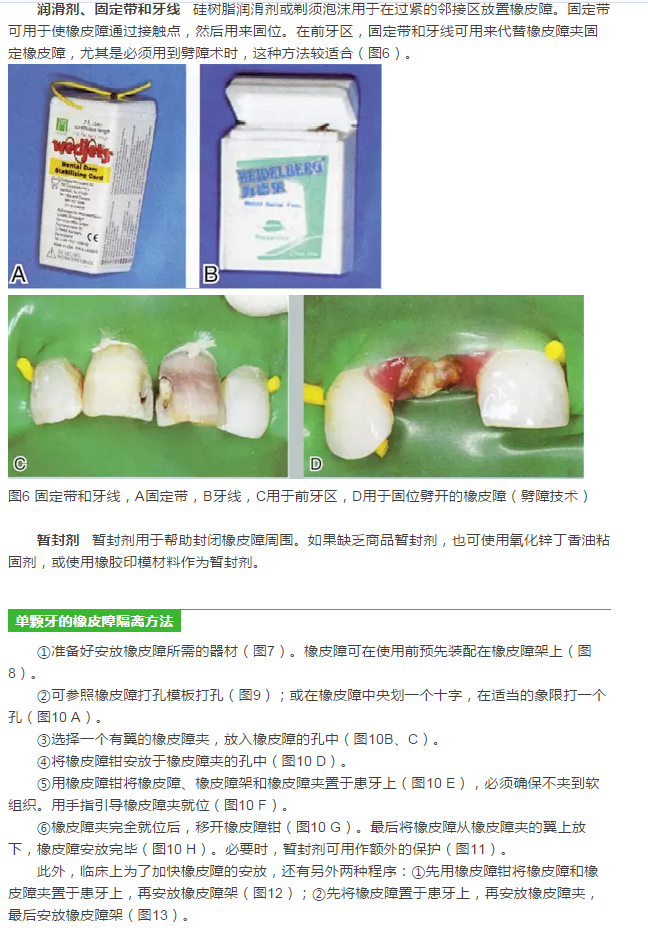 橡皮障隔離之單顆牙隔離方法——陳智教授