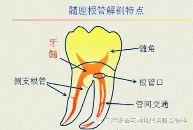 超實用的根管口的探查術