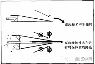 即使是老手也會失手的麻醉----下牙槽、舌、頰一次阻滯麻醉