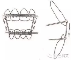 口腔醫(yī)學(xué)主治醫(yī)師筆試-精講強(qiáng)化-齲病牙體硬組織牙髓病和根尖周