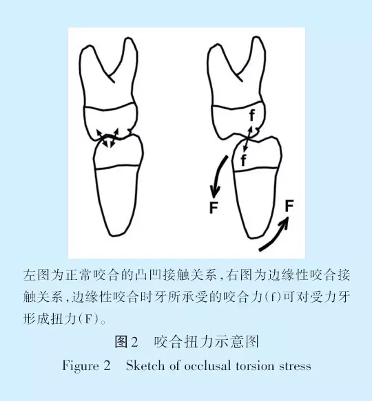 王美青.淺談咬合修復重建中的（牙合）學問題