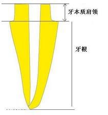 纖維樁臨床操作步驟