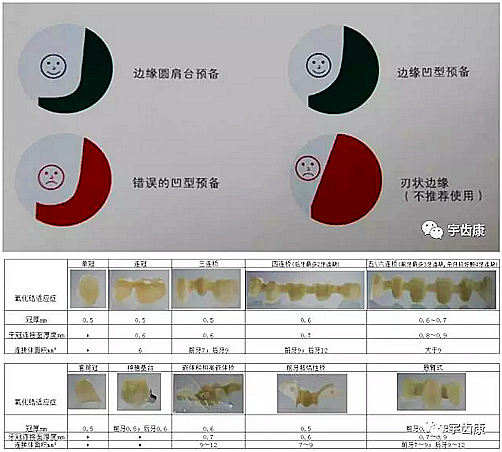 影響全瓷牙冠裂的因素有哪些？