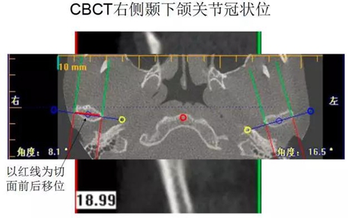 	口腔修復治療中，常見臨床接診流程