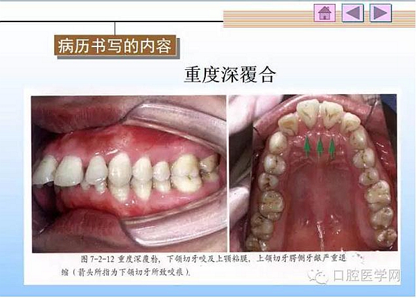 口腔正畸學(xué)病歷書寫  