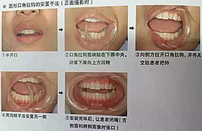 口腔攝影方法與技巧