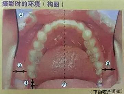 口腔攝影方法與技巧