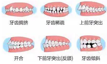 關于牙齒矯正，你想知道的都在這！