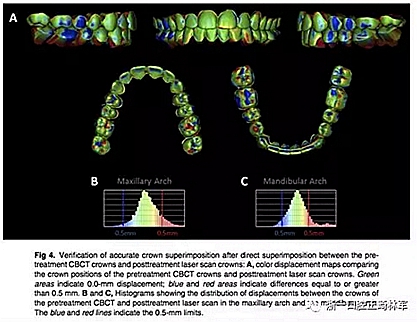 正畸文獻閱讀--正畸過程中牙根移動的三維監(jiān)測