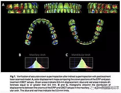 正畸文獻閱讀--正畸過程中牙根移動的三維監(jiān)測