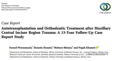 文獻優秀正畸病例賞析--上頜中切牙區受傷后自體牙移植及正畸治療13年隨訪病例