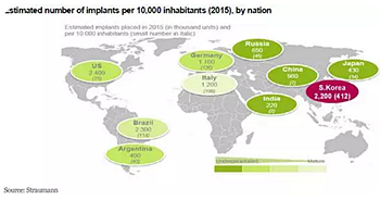 種植體，在全球牙科設備市場的變化！