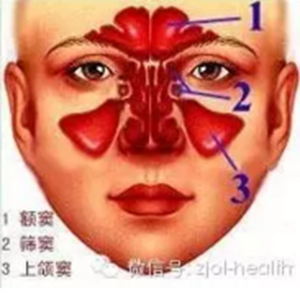 拔牙后引出“偏頭痛”！這種情況絕不能置之不理！