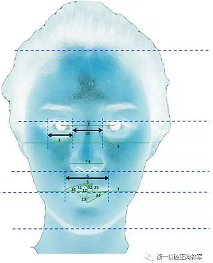 正畸文獻閱讀--對美貌年輕女性面部尺寸的分析