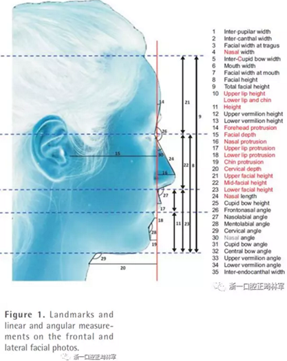正畸文獻閱讀--對美貌年輕女性面部尺寸的分析