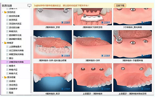 牙科普通前臺和優(yōu)秀前臺到底差在哪？