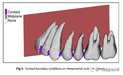 正畸文獻閱讀--對于滑動法關閉間隙的有限元分析
