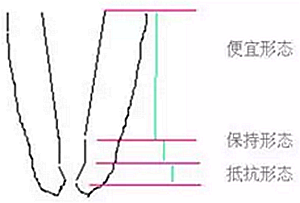 知識分享：根管治療的標準步驟