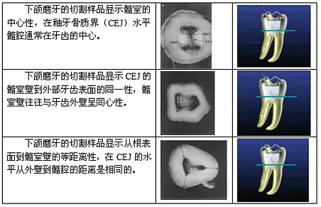 知識分享：根管治療的標準步驟