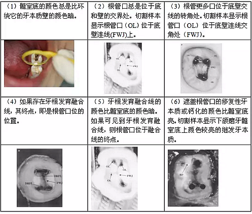 知識分享：根管治療的標準步驟