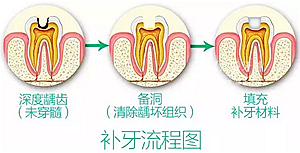 你總嚷著看牙“貴”還不是你自己造成的