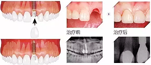 你總嚷著看牙“貴”還不是你自己造成的