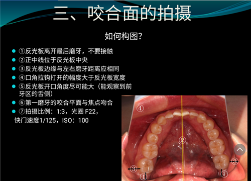 口內(nèi)照攝影方法與技巧分享