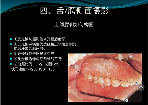 口內(nèi)照攝影方法與技巧分享