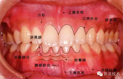 上海品瑞邁格磁致伸縮治療儀