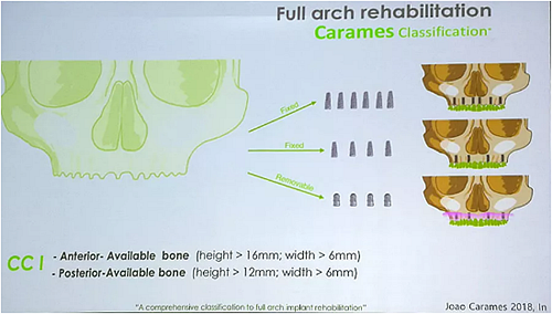 【熱點回顧】帶您深度了解無牙頜種植修復——Pro Arch