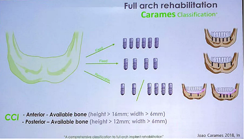 【熱點回顧】帶您深度了解無牙頜種植修復——Pro Arch