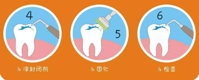 兒童齲病的預防