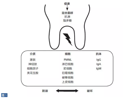 根尖周炎的病因與癥狀