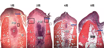 血液衍生物PRF&CGF在牙槽窩處理中的應用