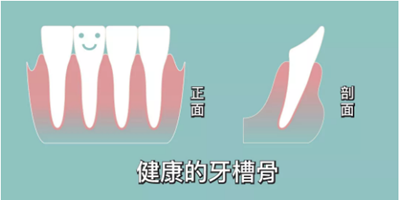 正畸矯正