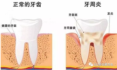 什么是牙齦萎縮？