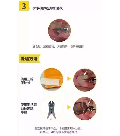 特殊時期為什么常規的口腔治療都不能做了？