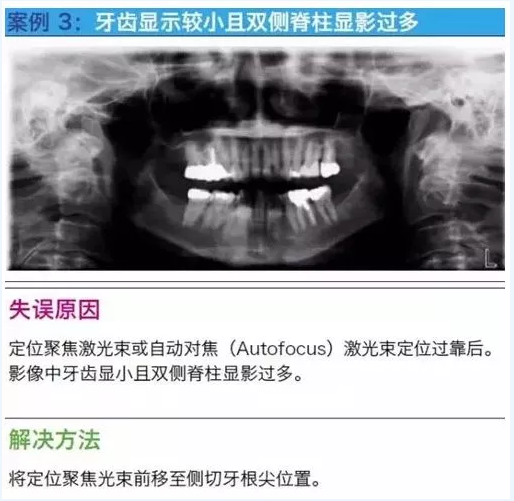 曲斷的10大經典失誤案例及原因分析！