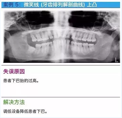 曲斷的10大經典失誤案例及原因分析！