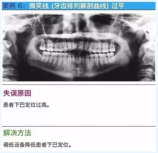 曲斷的10大經典失誤案例及原因分析！