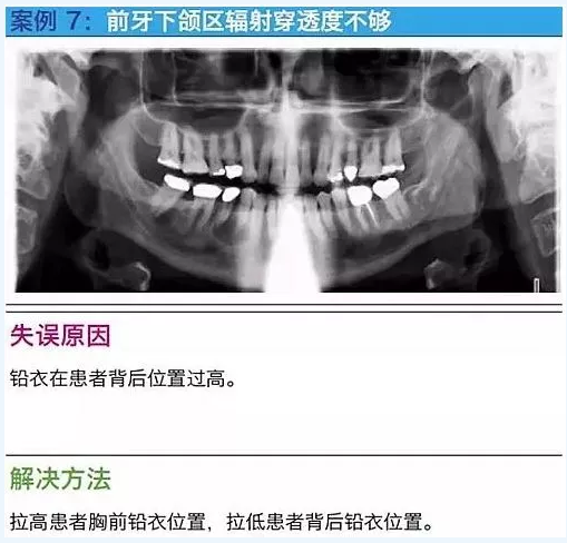 曲斷的10大經典失誤案例及原因分析！