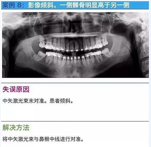 曲斷的10大經典失誤案例及原因分析！