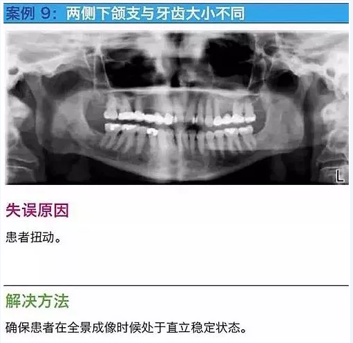 曲斷的10大經典失誤案例及原因分析！