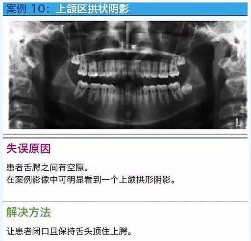 曲斷的10大經典失誤案例及原因分析！