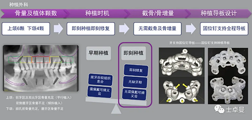 【病例分享】應用全程數字化對牙周炎患者實現全口即刻種植即刻修復