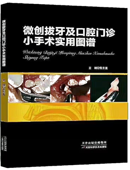 微創拔牙及口腔門診小手術實用圖譜——張東星